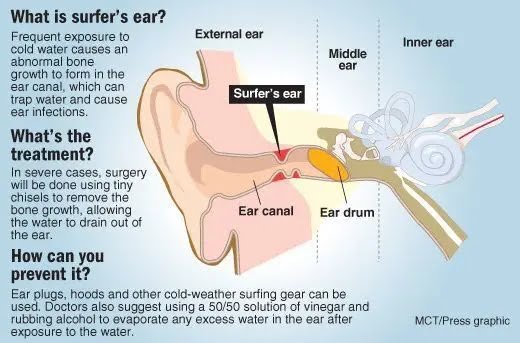 La oreja del surfista